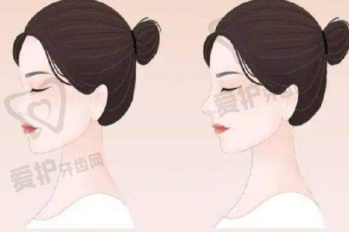 重庆当代整形外科医院做中面部拉皮提升的优势