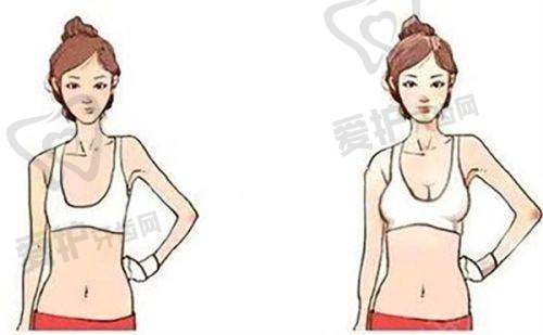顾客对王旭明医生硅胶 + 半肋软骨隆鼻综合项目的口碑