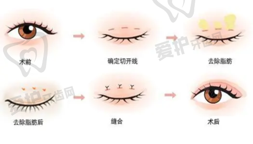 林文祥医生技术特色