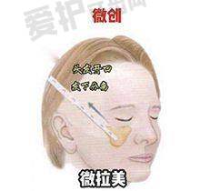 吴安营医生擅长项目