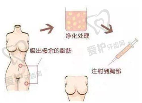 深圳健丽心歌医疗美容门诊部管谋医生擅长项目
