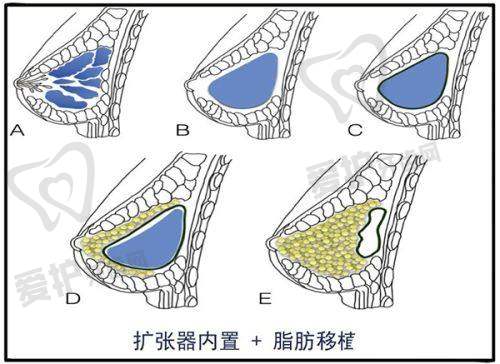 深圳宝丽医疗美容门诊部收费价格表