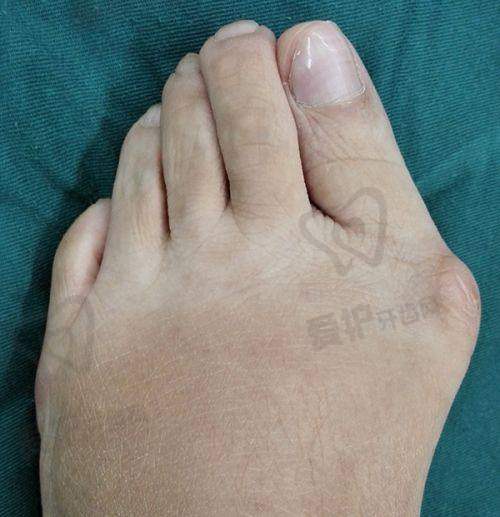 深圳秀禾医疗美容诊所祁荣医生怎么预约挂号