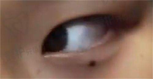 陈敬武医生技术特色