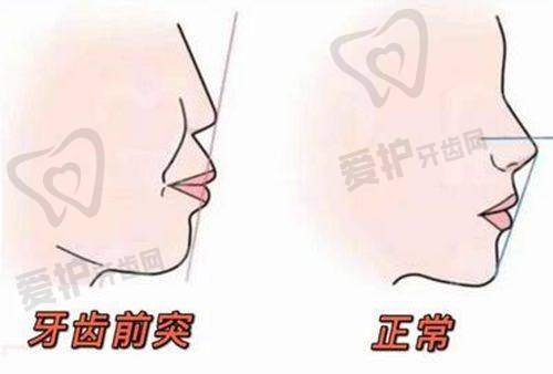如何选择适合自己的修复方法