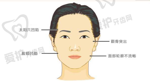 深圳星荟丽格医疗美容诊所徐斌医生技术特色
