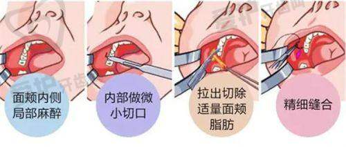 深圳星荟丽格医疗美容诊所罗婕姝医生怎么预约挂号