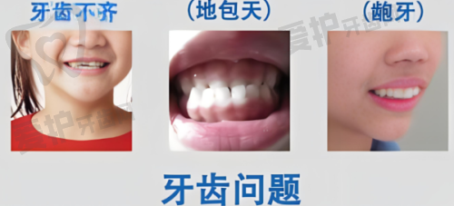 深圳诺德齿科收费优势及预约方式