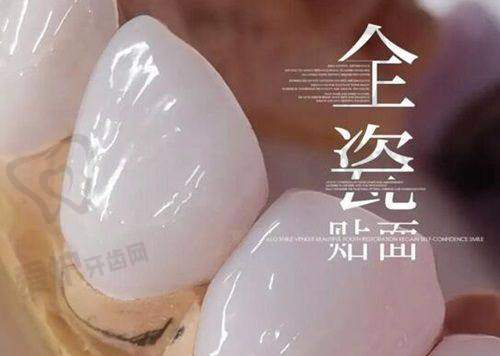 深圳诺德齿科牙修复项目收费标准