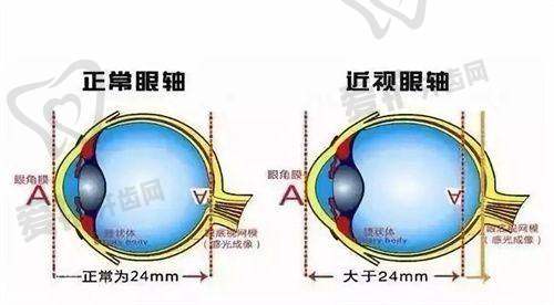 贵阳阳明眼科医院胡婷婷的患者评价与口碑