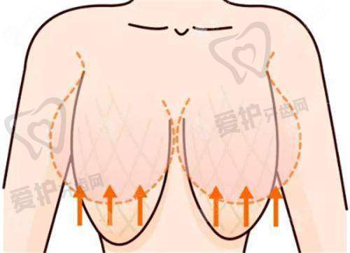 济南诺德医疗美容医院王东平医生擅长项目