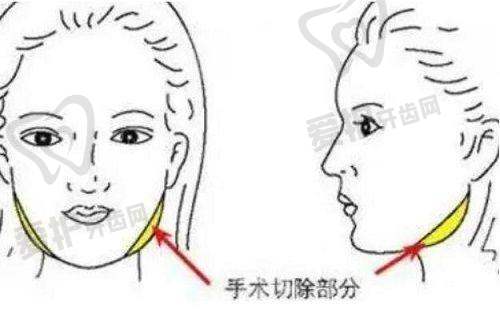 长沙长海医院医疗美容科预约方式