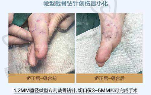 王苹医生技术特色
