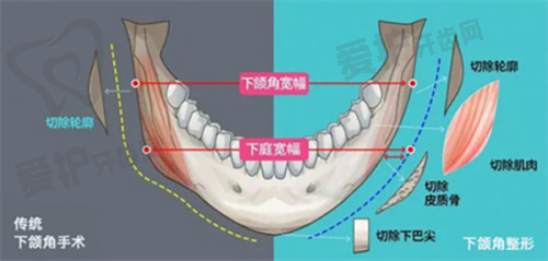 济南诺德医疗美容医院陈三群医生技术特色