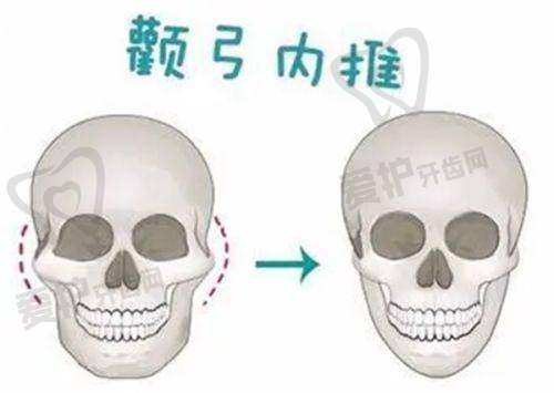 济南诺德医疗美容医院姚军 医生怎么预约挂号