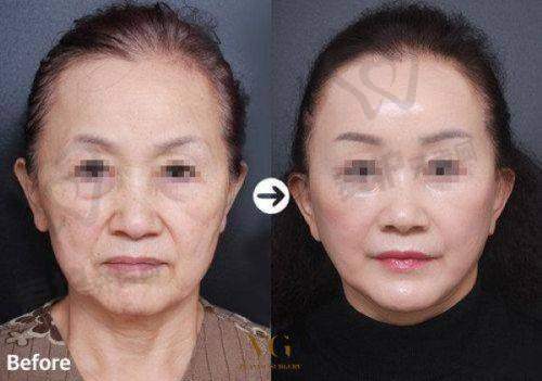 长沙美诺美和医疗美容门诊部预约方式