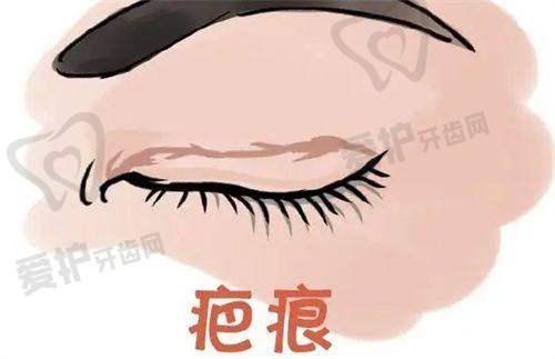 长沙爱思特医疗美容医院王谊医生真实的患者口碑评价