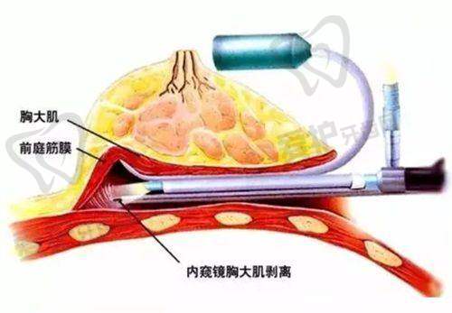 长沙雨花宸美医疗美容门诊部杨云医生怎么预约挂号