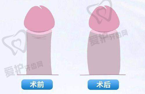 长沙爱思特医疗美容医院彭远清医生技术特色