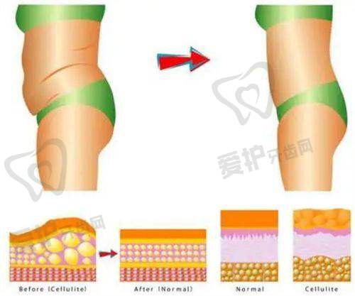 长沙艺星医学美容医院预约方式