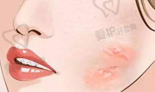 长沙爱思特医疗美容医院张姣姣医生真实的患者口碑评价