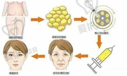 长沙爱思特医疗美容医院杨千里医生真实的患者口碑评价