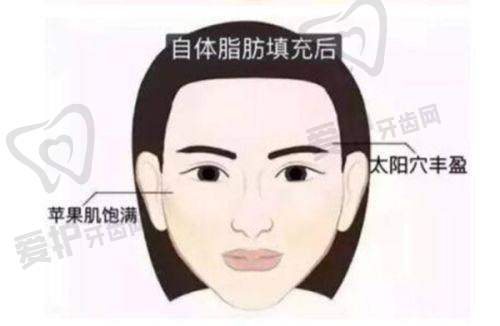 长沙雨花宸美医疗美容门诊部杨云医生擅长项目