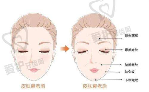 在实际应用中,有没有联合使用玻尿酸和胶原蛋白的情况?