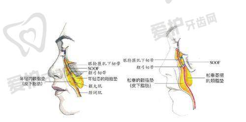 玻尿酸填充和胶原蛋白填充的价格大概是多少?