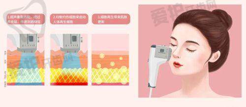 昆明韩辰医疗美容医院做水动力腰腹 + 大腿吸脂项目的优势