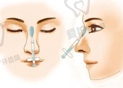 医院做欧洲之星Pro眼周+薇旖美胶原项目的具体优势