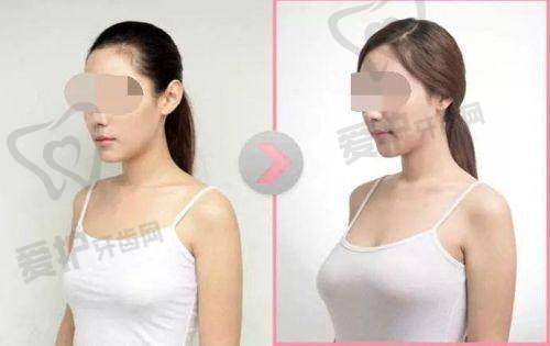 选择西安画美医疗美容医院的理由