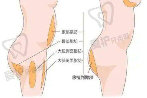 沈阳名流整形医院收费价格表