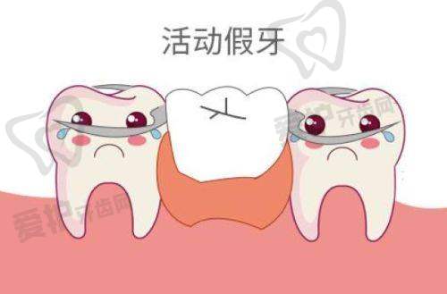 青岛优诺口腔做前牙根管治疗的具体优势