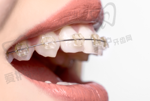 青岛优诺口腔超声波洁牙178元起，去除污垢防问题，专业设备与服务超贴心