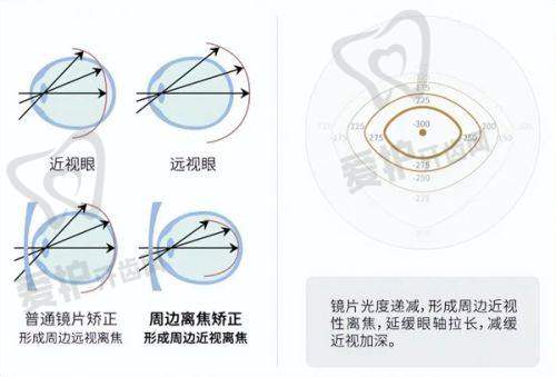 邯郸爱尔眼科医院营业时间