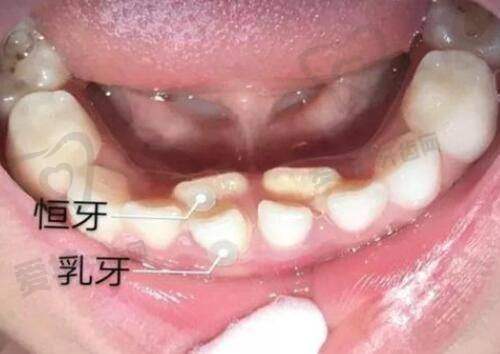 沈阳小树医疗美容诊所(浑南院区)收费价格表