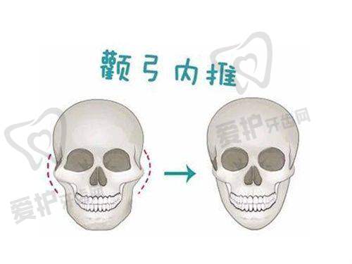 2025大连面部填充物取出医院详细介绍