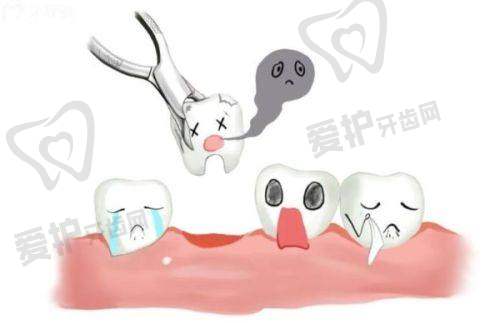 衡水可恩口腔医院赵志娟做时代天使隐形矫正13800元起，美观舒适疗程短还服务贴心