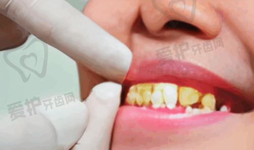 广州德仁口腔的医疗团队实力