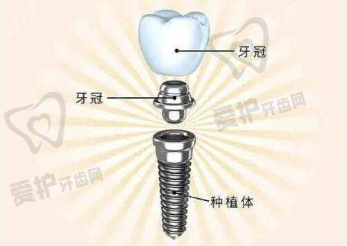 扬州杨京口腔的诊疗项目与价格