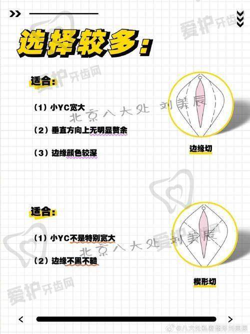 昆明韩辰医疗美容医院做小阴唇手术的具体优势