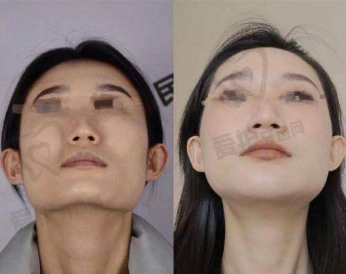患者的真实口碑评价