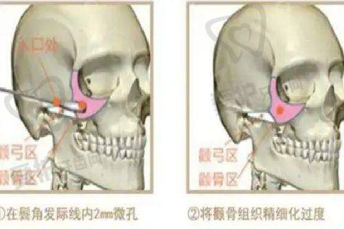 上海华美医疗美容医院简介