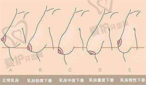 句子侦探