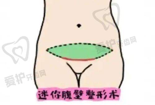 沈阳杏林整形外科医院崔昌墉医生真实的患者口碑评价