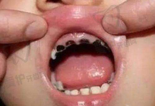 患者的真实口碑评价