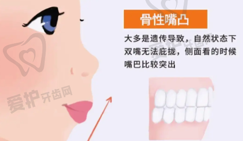 从美观度上看，吸附性活动义齿和普通义齿哪个更好？