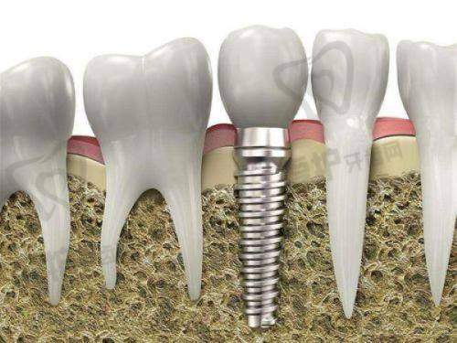 重庆观音桥牙科项目深度解析：8类治疗价格+避坑指南