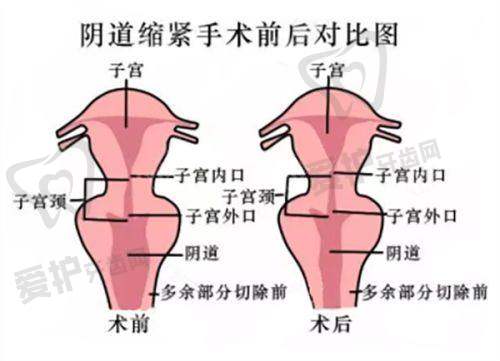 沈阳杏林整形外科医院范东良医生真实的患者口碑评价